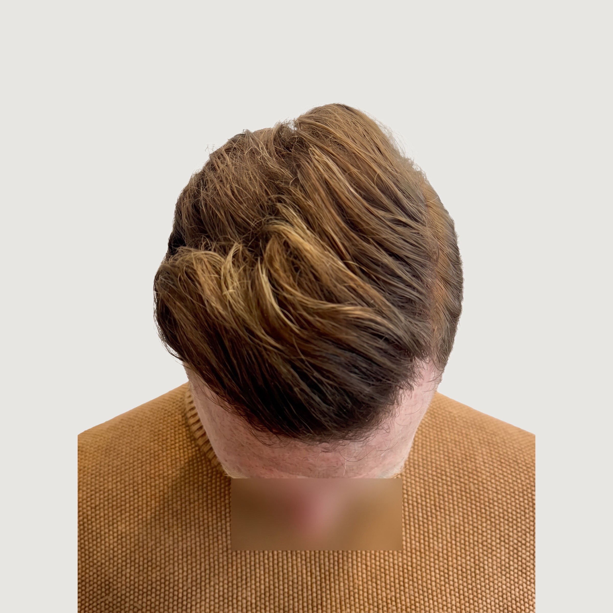 12 Months — Alex's Final Result