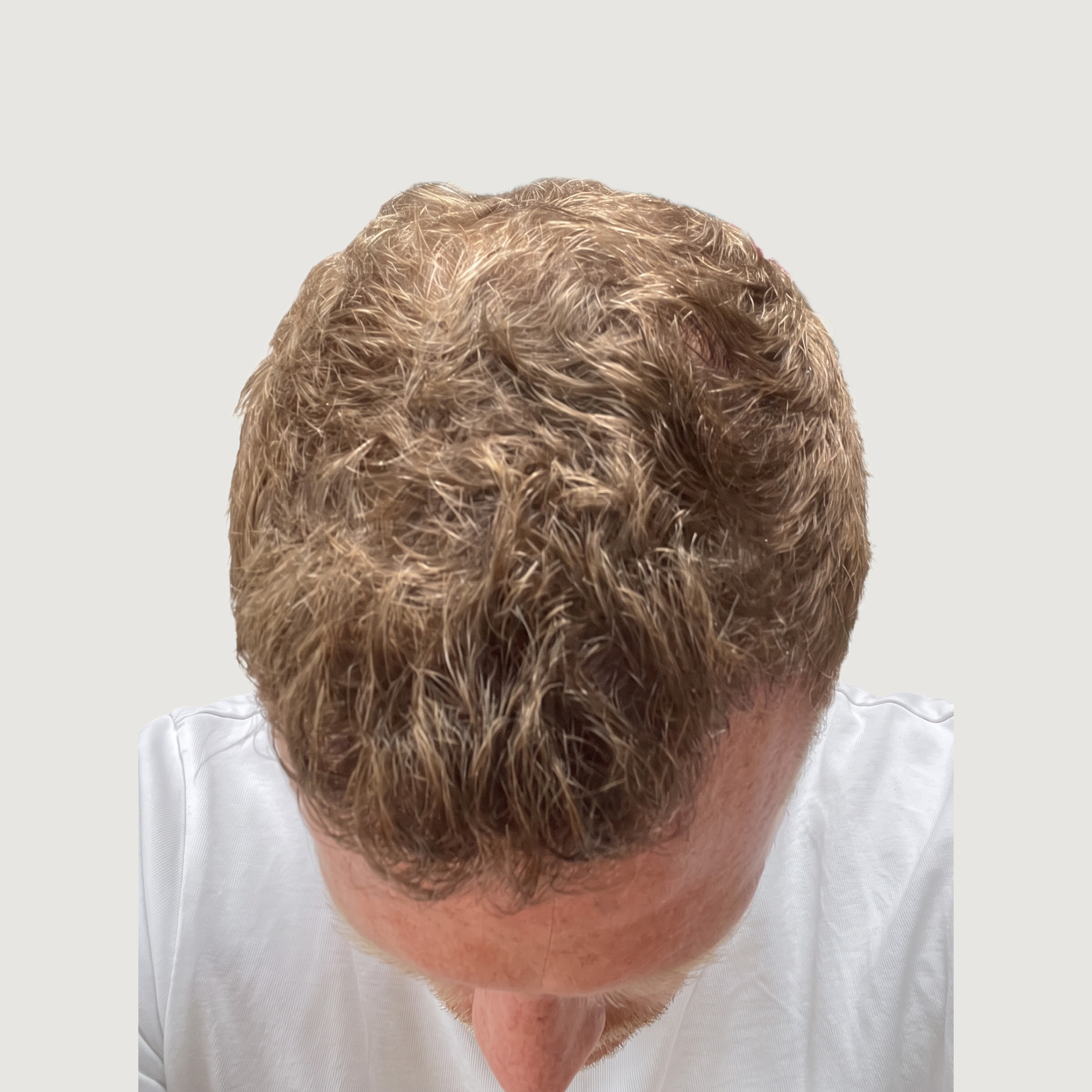 6 Months — The Transformation Is Taking Shape