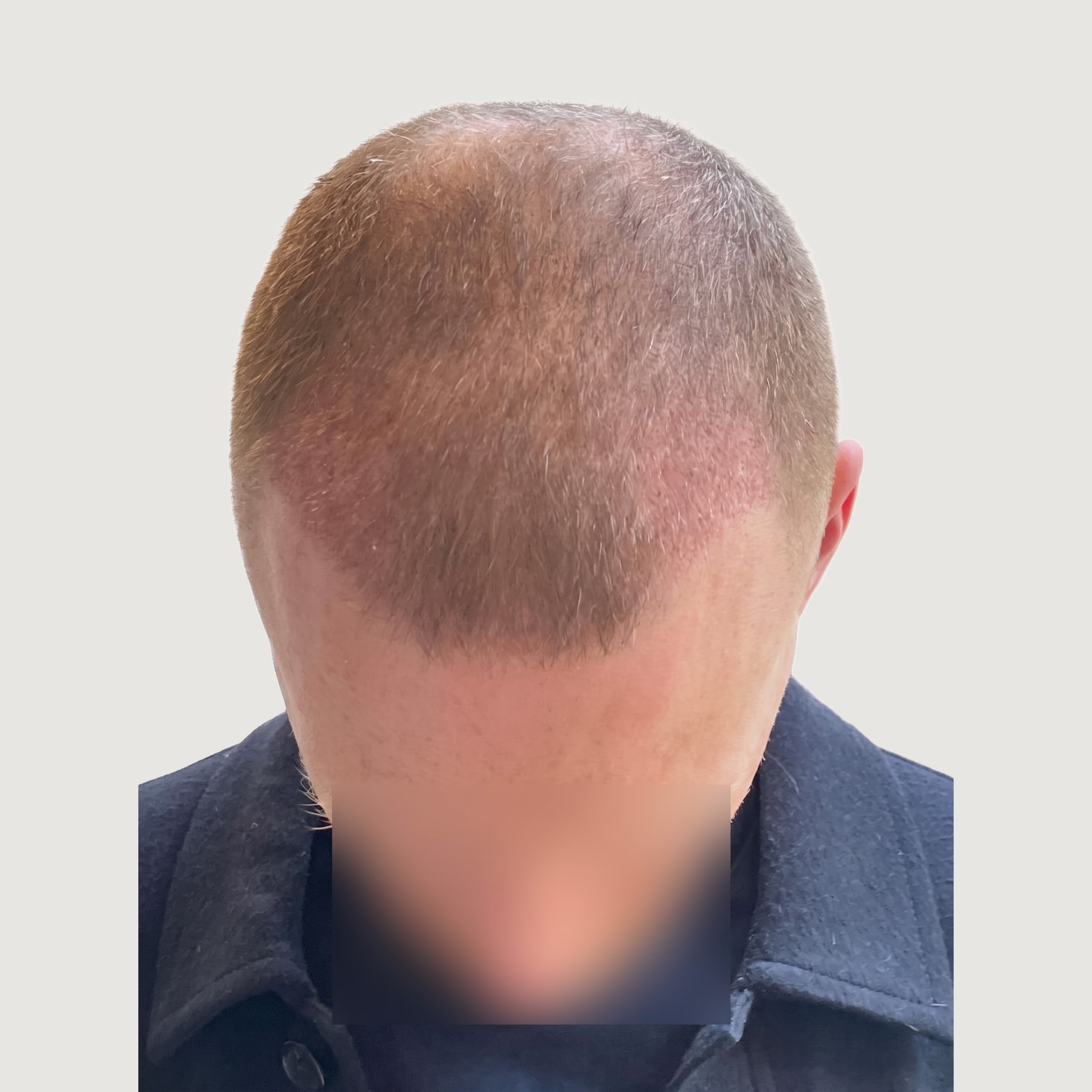 6–12 Weeks — The First Signs Of Growth